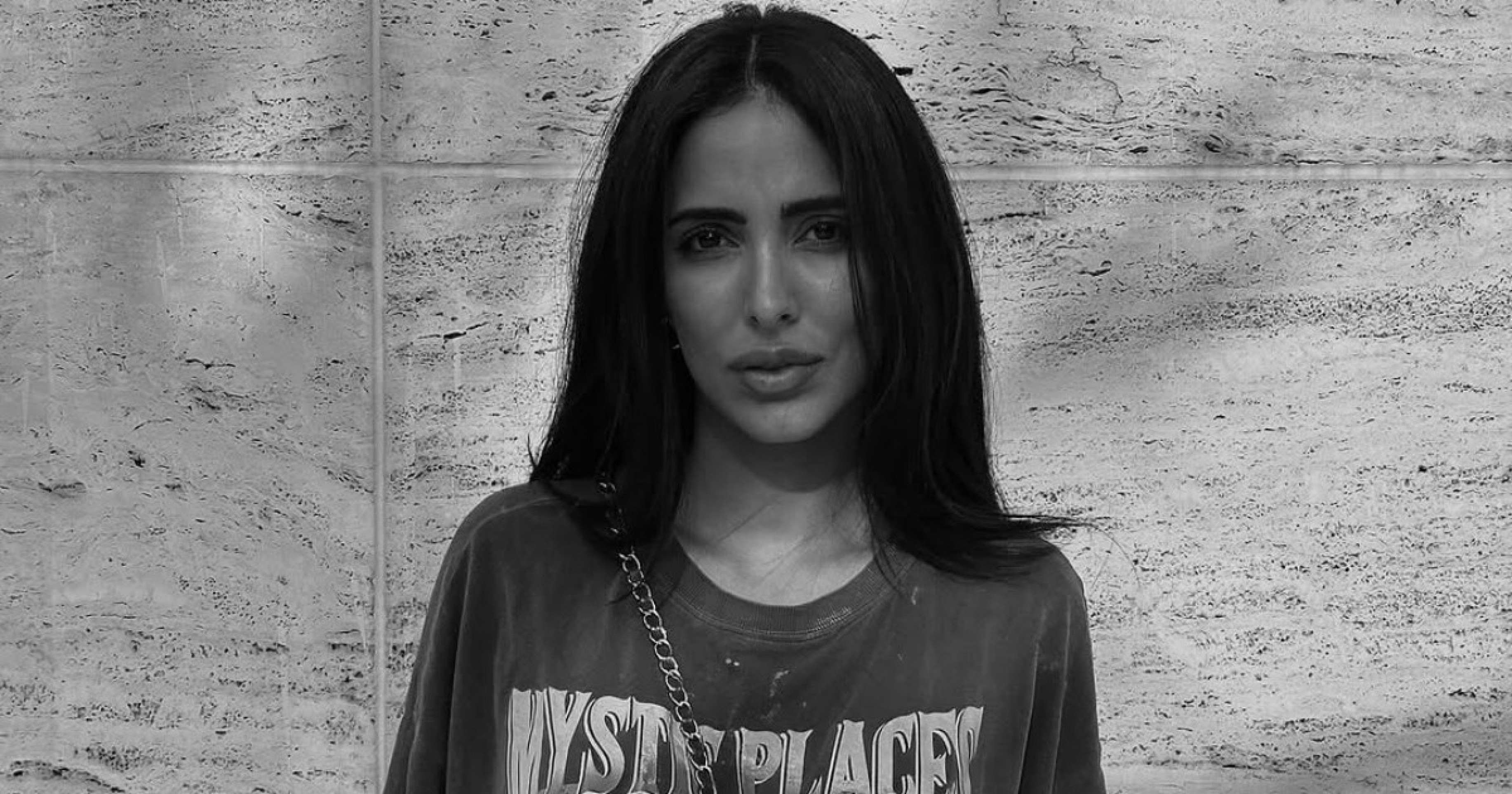 Jade Seba realiza cirurgia para correção de ptose mamária na JK Estética Avançada