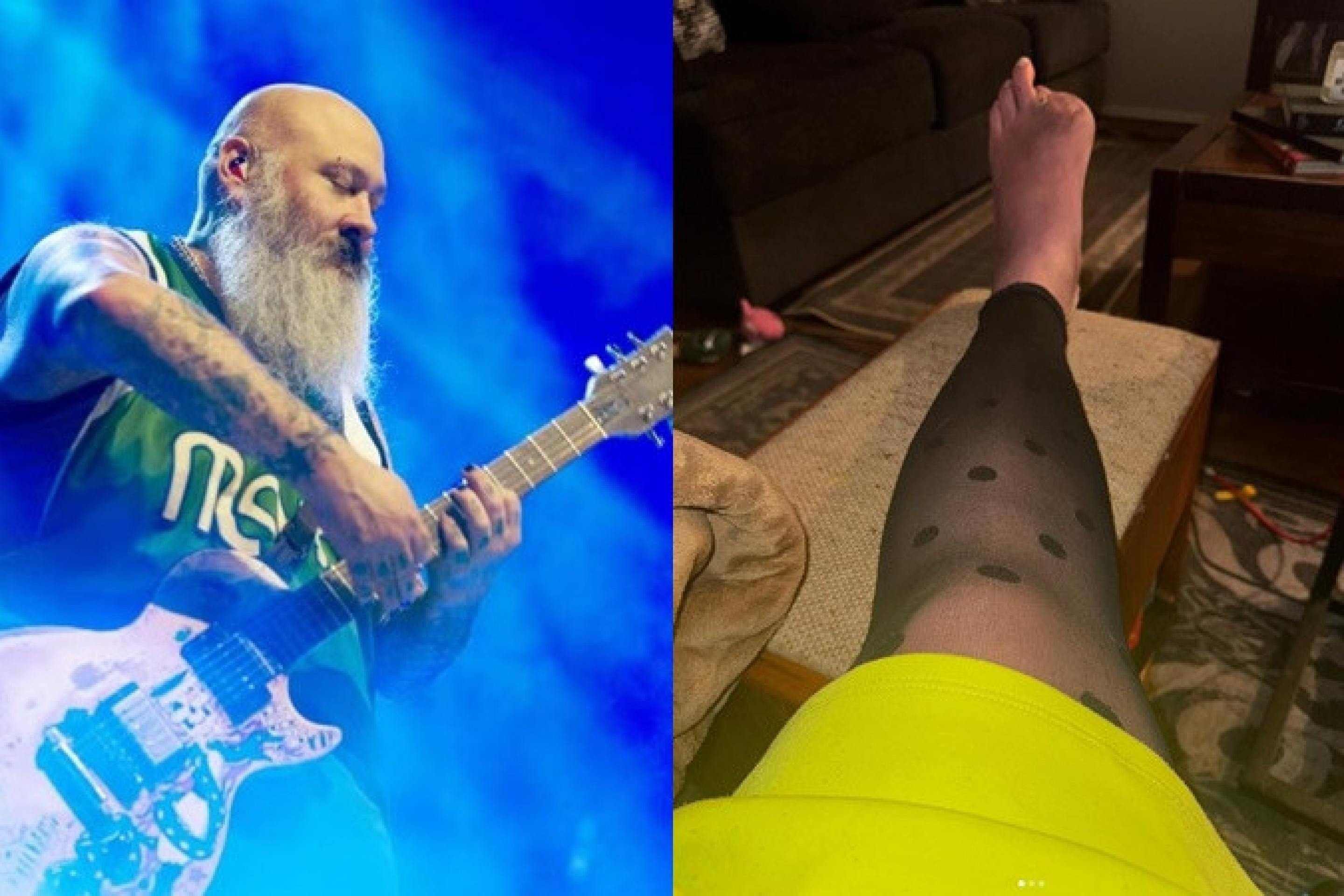 Ex-guitarrista de banda de rock tem dedos do pé amputados