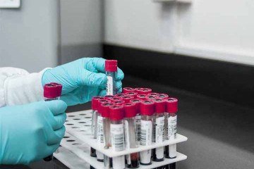 Elas também atuam na redução dos níveis de colesterol LDL, também conhecido como o colesterol “ruim” e
ajudam a regular os níveis de açúcar no sangue, fator importante para quem possui quadro de diabetes, sobretudo a mellitus (tipo 2).
 -  (crédito: Imagem Pixabay)