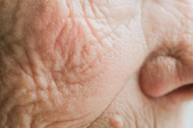 A pele é que mais sofre com o passar dos anos e com fatores externos - (crédito: Pexel/Divulgação ) A pele é que mais sofre com o passar dos anos e com fatores externos - (crédito: Pexel/Divulgação )