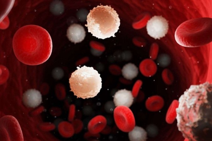 A leucemia é um câncer comum (Imagem: 3dMediSphere | Shutterstock) - (crédito: EdiCase) A leucemia é um câncer comum (Imagem: 3dMediSphere | Shutterstock) - (crédito: EdiCase)