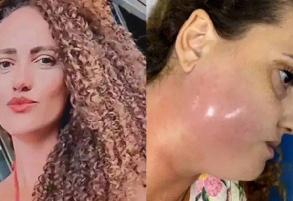 Reprodução/Redes sociais