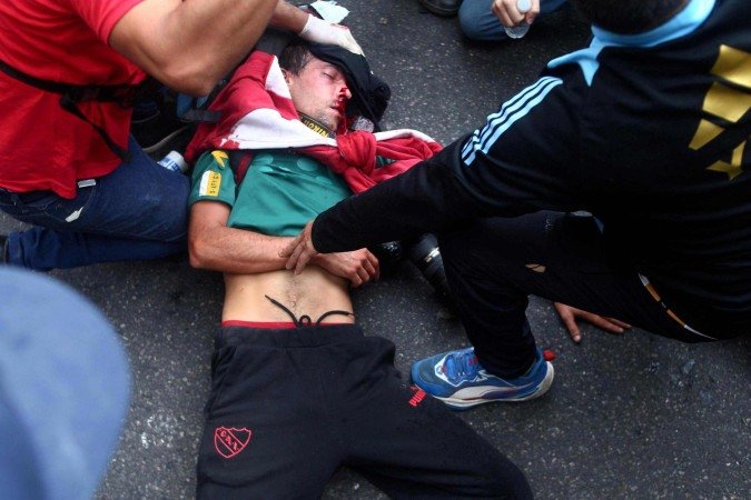  Argentinean photojournalist Pablo Grillo receives medical treatment by paramedics after being injured during a protest of pensioners supported by football fans against the government of President Javier Milei in Buenos Aires on March 12, 2025. (Photo by Nicolas SUAREZ / AFP)
      Caption 
