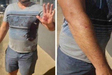 Vítima foi agredida no braço direito, na mão esquerda e no lado esquerdo do tórax -  (crédito: PMMG/Divulgação)