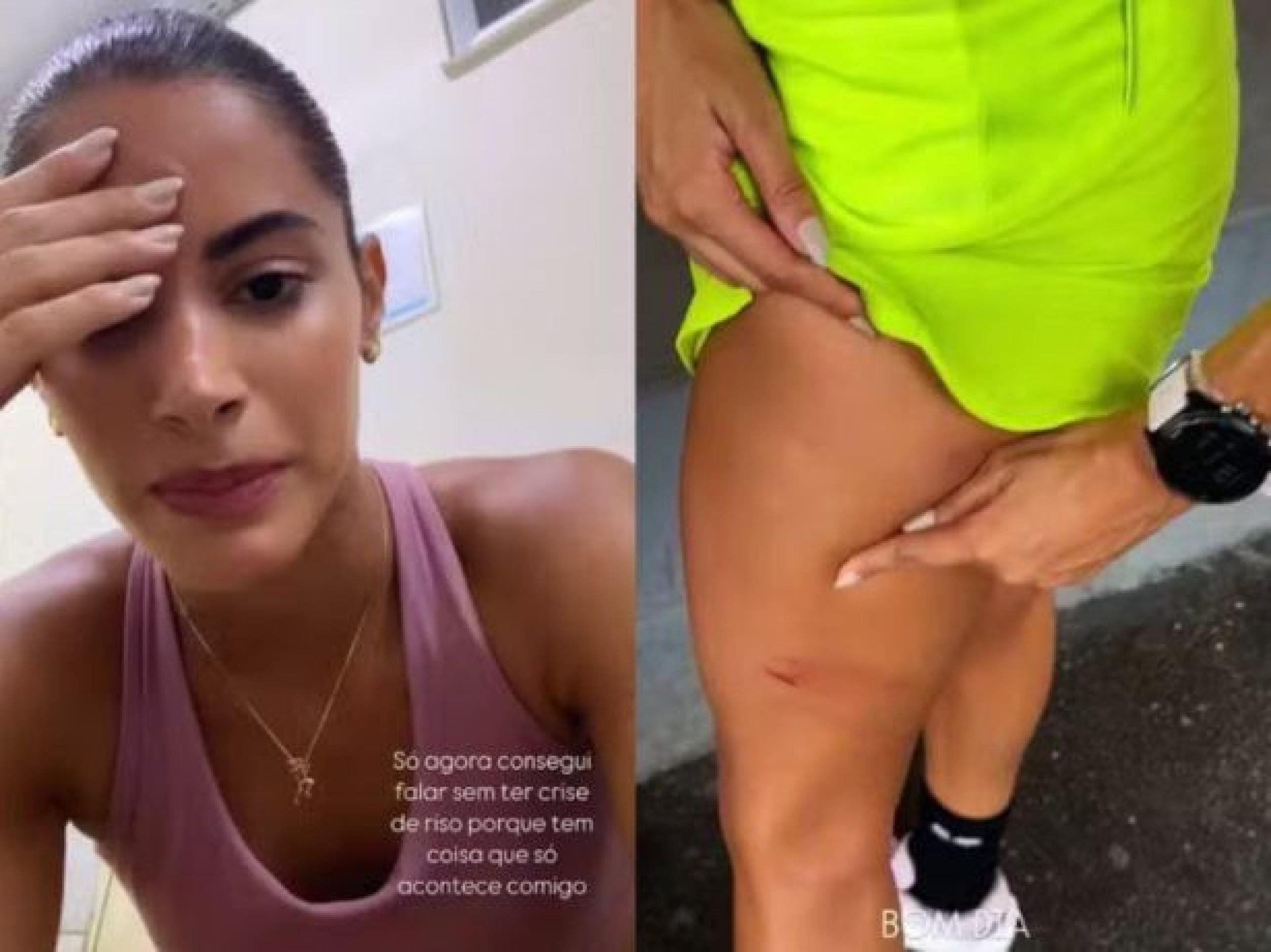 Atriz sofre lesões após ser atacada por cinco cães