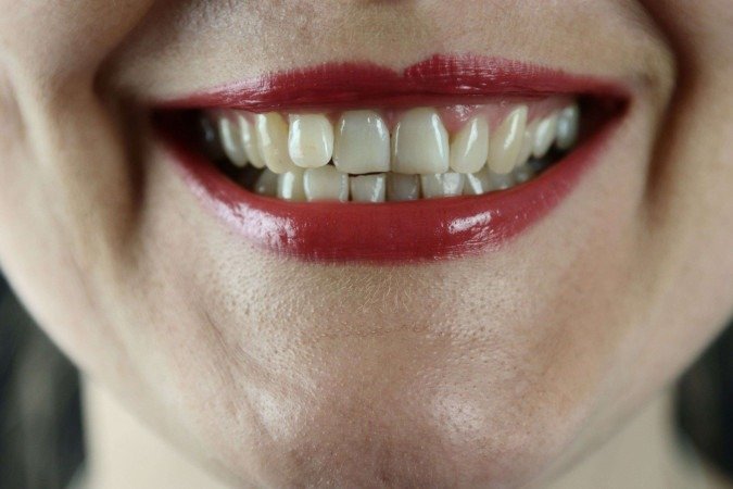 As flutuações hormonais a que as mulheres são submetidas ao longo de sua vida podem influenciar o equilíbrio da microbiota oral, conforme dentista - (crédito: Marek Studzinski/Unsplash) As flutuações hormonais a que as mulheres são submetidas ao longo de sua vida podem influenciar o equilíbrio da microbiota oral, conforme dentista - (crédito: Marek Studzinski/Unsplash)