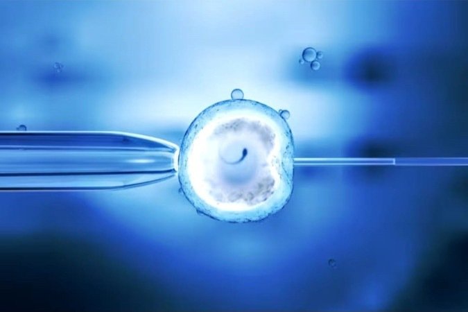 Processo de fertilização in vitro - (crédito: Reprodução/Shutterstock ) Processo de fertilização in vitro - (crédito: Reprodução/Shutterstock )