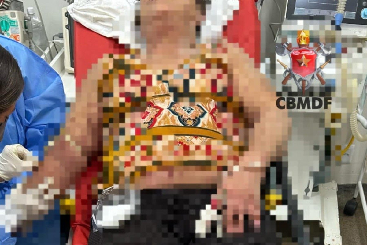 Idosa é atacada por enxame de abelhas em Samambaia. Área é isolada