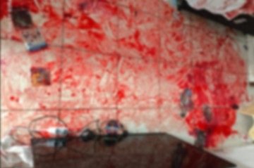 Mulher levou 32 facadas e está em estado grave no hospital -  (crédito: Material cedido ao Correio)