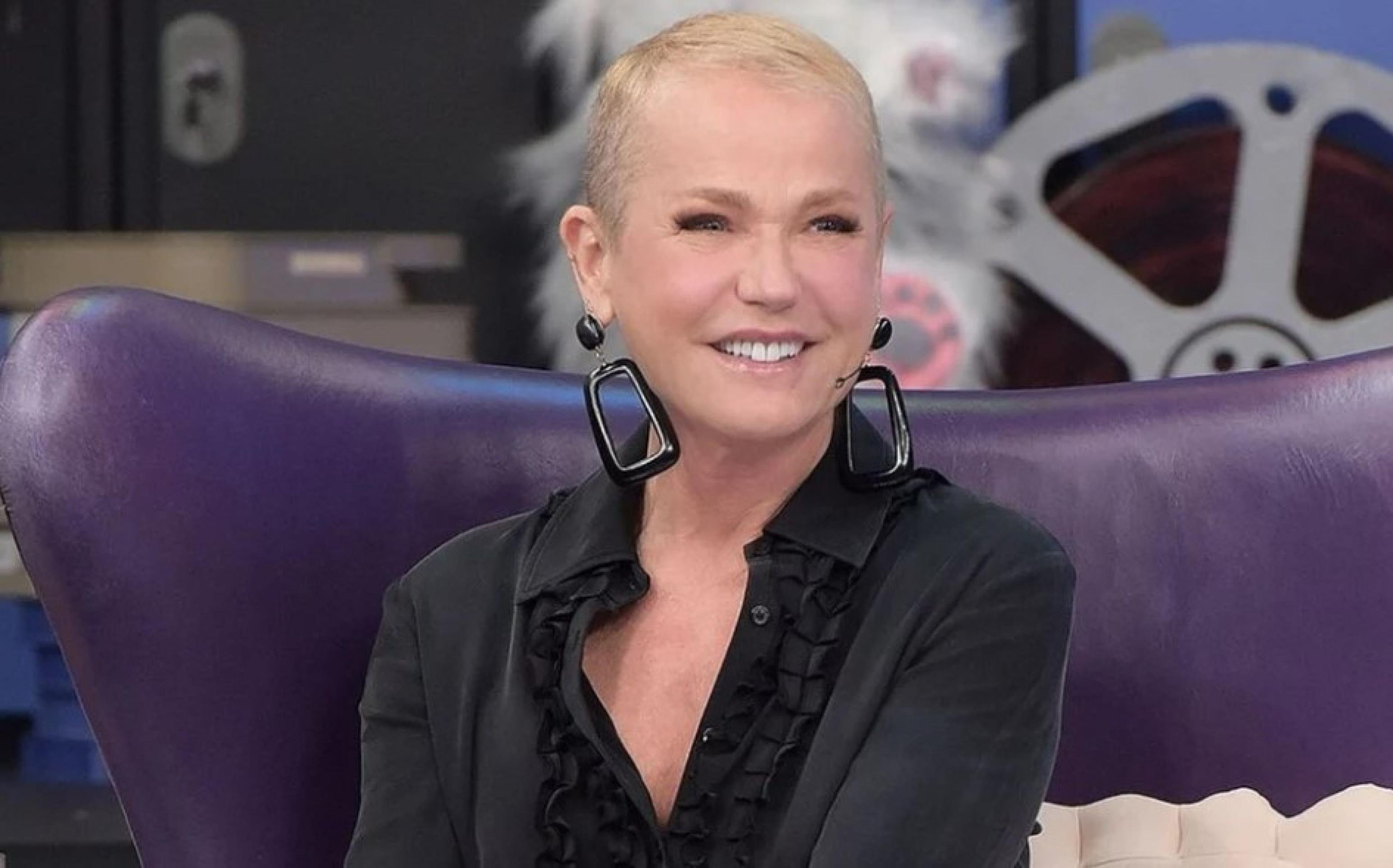 Xuxa passa por transplante capilar e revela detalhes do procedimento -  (crédito: Tupi - Pablo Oliveira)