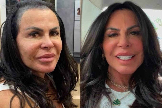 Mega hair em reality show: Visual de Gretchen no Power Couple chama atenção
- (crédito: Instagram) Mega hair em reality show: Visual de Gretchen no Power Couple chama atenção
- (crédito: Instagram)
