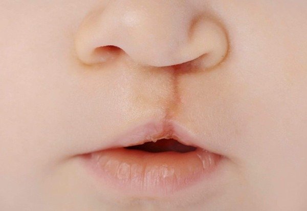 Getty Images/iStockphoto