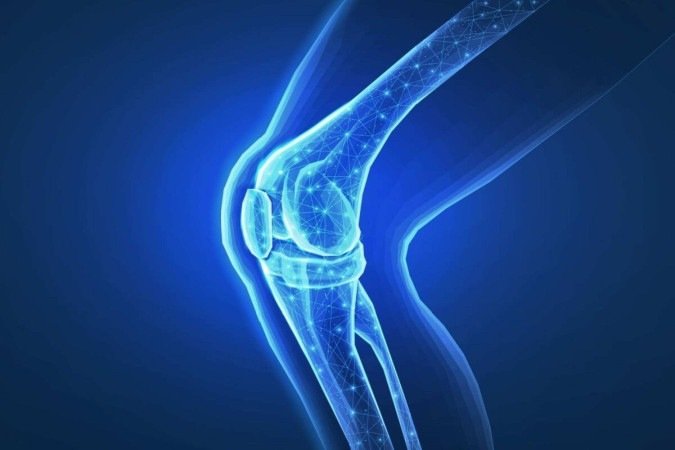 A artrite séptica é uma doença causada por bactérias que afetam a articulação (Imagem: CoreDESIGN | Shutterstock) - (crédito: EdiCase) A artrite séptica é uma doença causada por bactérias que afetam a articulação (Imagem: CoreDESIGN | Shutterstock) - (crédito: EdiCase)