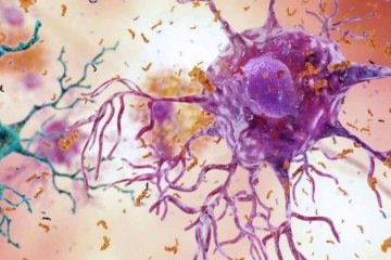 A inflamação ocorre poucos dias após a ingestão excessiva de gordura e está associada ao desenvolvimento de doenças metabólicas, como a obesidade -  (crédito: Divulgação/NIA/NIH)