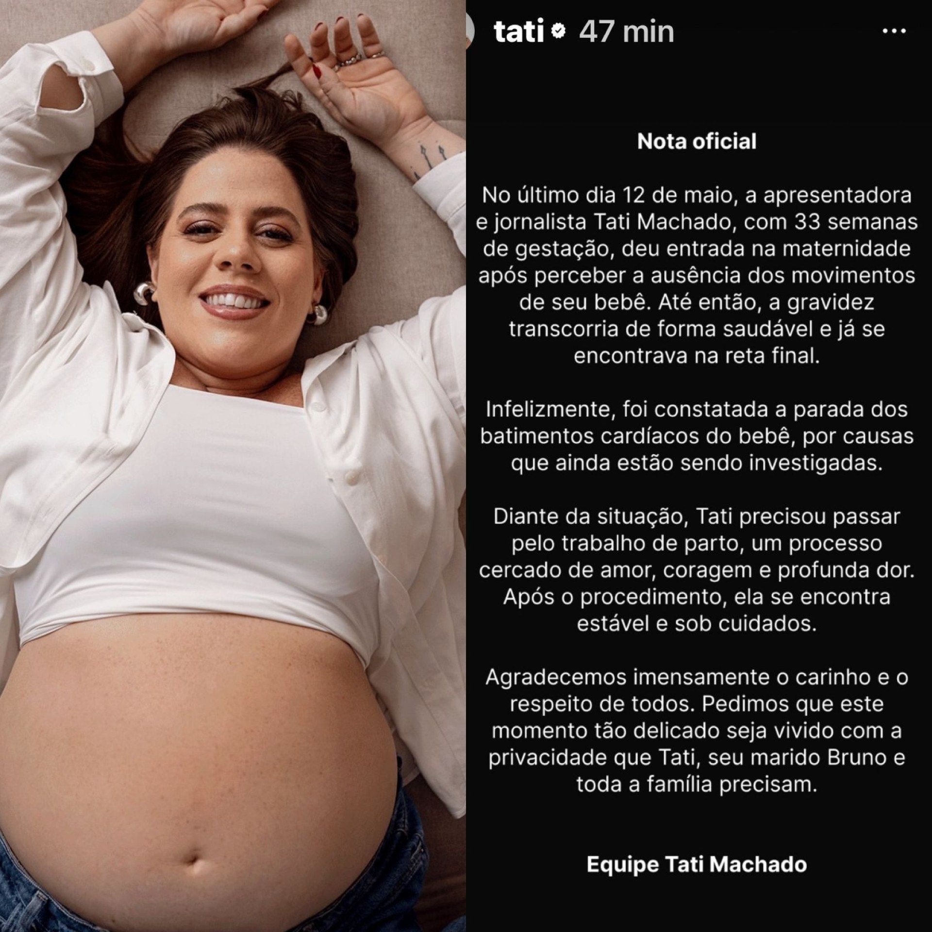 Tati Machado perde o bebê na reta final da gravidez e emociona o país