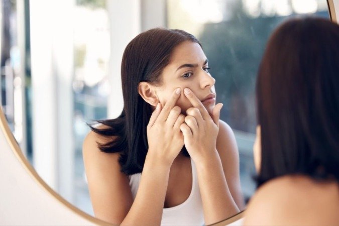 A acne na vida adulta é comum e pode ser tratada com cuidados especÃficos (Imagem: PeopleImages.com - Yuri A | Shutterstock) - (crédito: EdiCase) A acne na vida adulta é comum e pode ser tratada com cuidados especÃficos (Imagem: PeopleImages.com - Yuri A | Shutterstock) - (crédito: EdiCase)