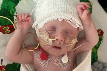 K.J passou os primeiros meses de vida no Hospital Infantil da Filadélfia
- (crédito: CHOP/Divulgação ) K.J passou os primeiros meses de vida no Hospital Infantil da Filadélfia
- (crédito: CHOP/Divulgação )