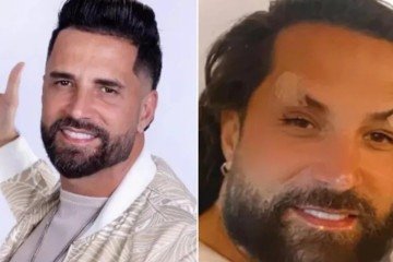 Latino vira alvo de piadas após exagerar na harmonização facial -  (crédito: Redes Sociais)