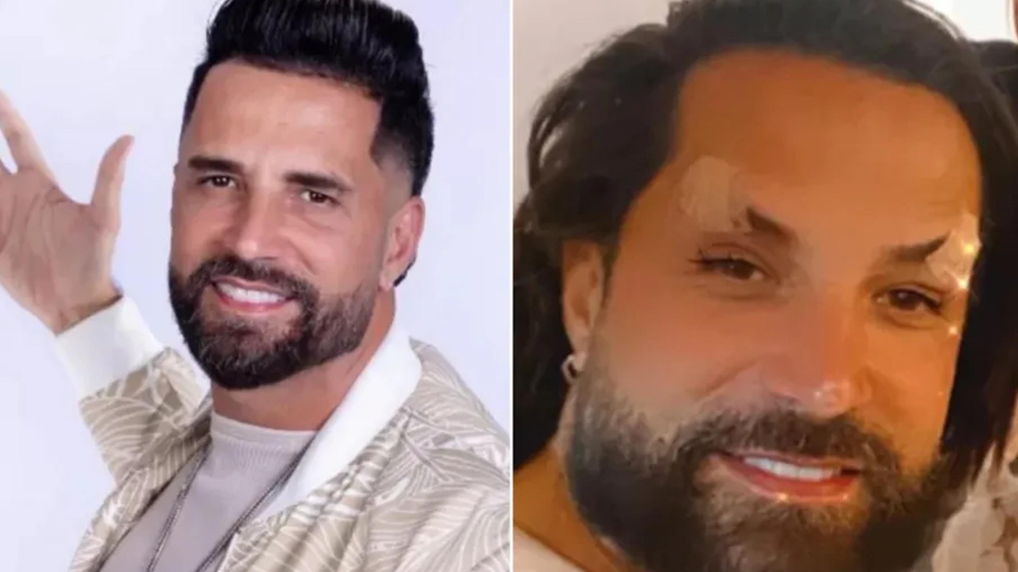Latino vira alvo de piadas após exagerar na harmonização facial Latino vira alvo de piadas após exagerar na harmonização facial