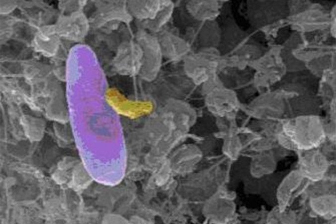 De acordo com a Organização Mundial da Saúde (OMS), cerca de 7,7 milhões de pessoas morreram em 2019 em decorrência de infecções bacterianas - (crédito: Reprodução da The University of Medicine and Dentistry of New Jersey) De acordo com a Organização Mundial da Saúde (OMS), cerca de 7,7 milhões de pessoas morreram em 2019 em decorrência de infecções bacterianas - (crédito: Reprodução da The University of Medicine and Dentistry of New Jersey)