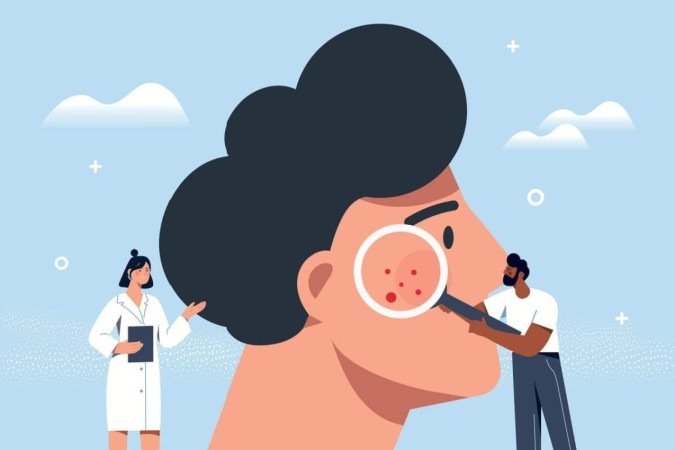 O câncer de pele é uma doença silenciosa e agressiva (Imagem: mentalmind | Shutterstock) - (crédito: EdiCase) O câncer de pele é uma doença silenciosa e agressiva (Imagem: mentalmind | Shutterstock) - (crédito: EdiCase)