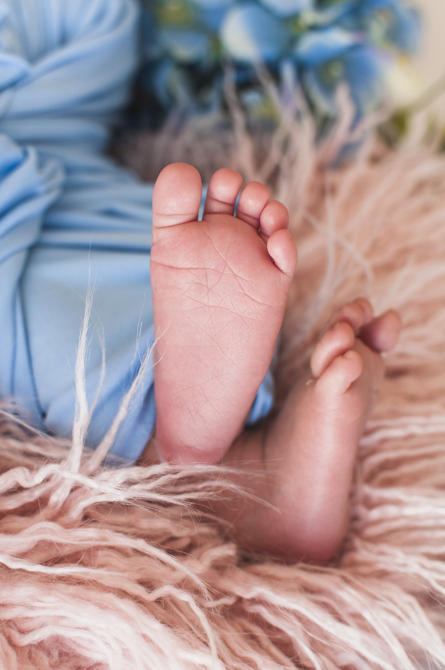 O raro caso do bebê que nasceu com DIU nas costas