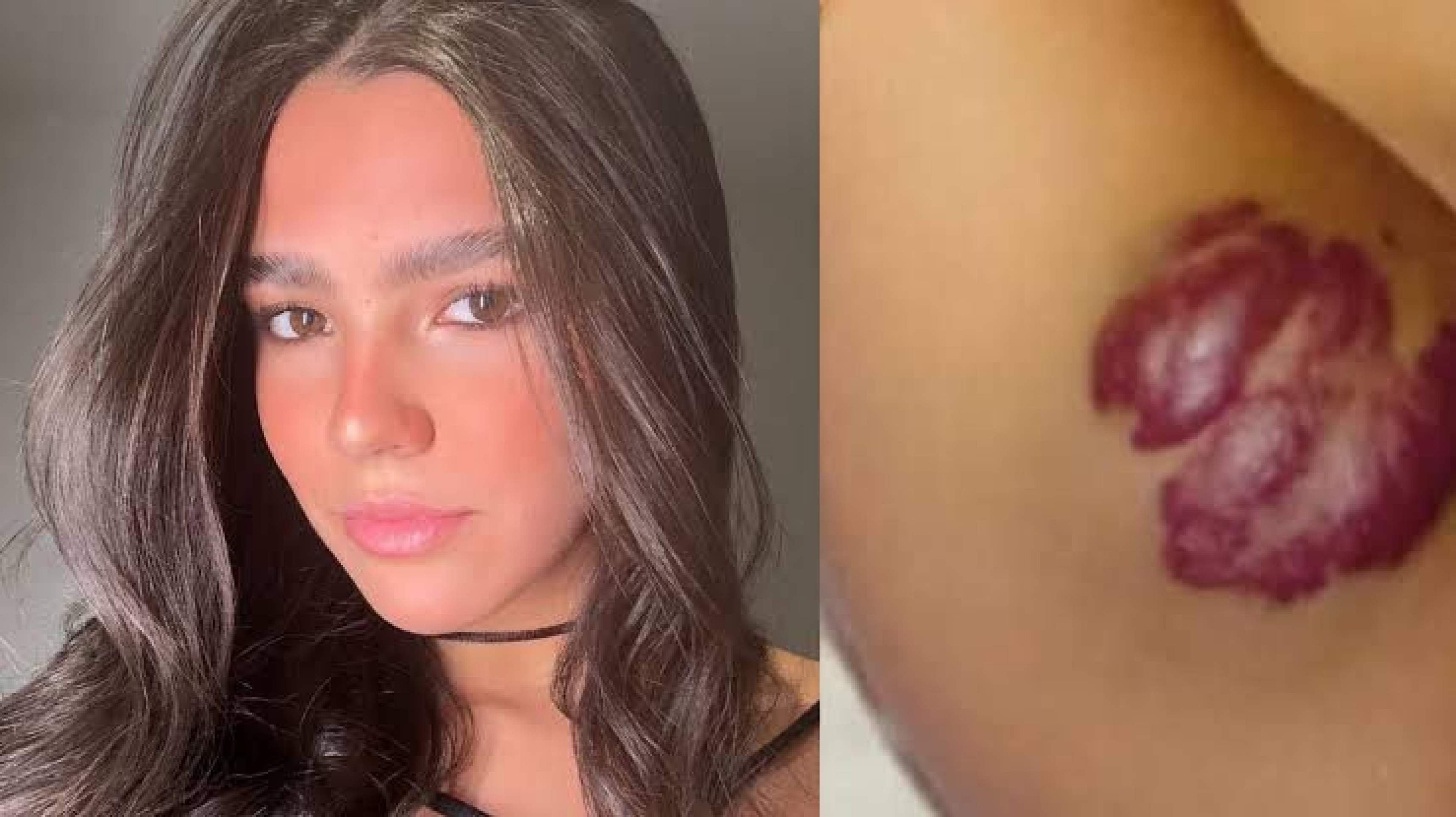 Aos 16 anos, Duda Guerra, ex de Benício Huck, revela diagnóstico de tumor