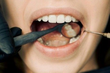 Saúde bucal -  (crédito: Arvind Philomin/Pexels)