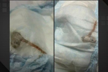 A fralda estava lacrada e sem sinais de violação, o que levanta suspeitas de falha na linha de produção -  (crédito: Reprodução/TV Globo)