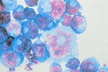  Células humanas infectadas: vírus permanece adormecido  por anos  -  (crédito: Johns Hopkins Medicine/Divulgação )