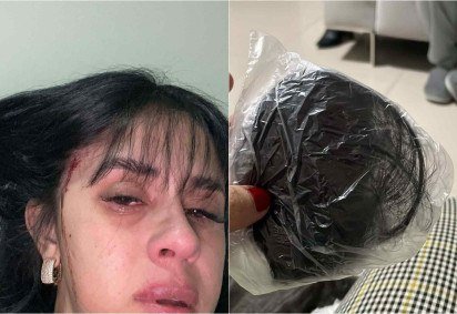A cantora sertaneja de Blumenau, em Santa Catarina Débora Amorim, por meio das redes sociais, contou ter sido vítima de um ataque violento na noite da última quinta-feira (29/5) -  (crédito: Reprodução/Instagram/@deboraamorimofc)