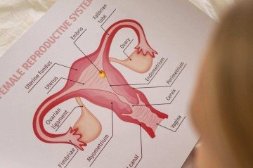 Dor em exames ginecológicos não é normal  -  (crédito: Freepik)