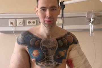 Influenciador russo a por cirurgia para retirar substâncias que injetou no bíceps -  (crédito: Reprodução/Instagram)