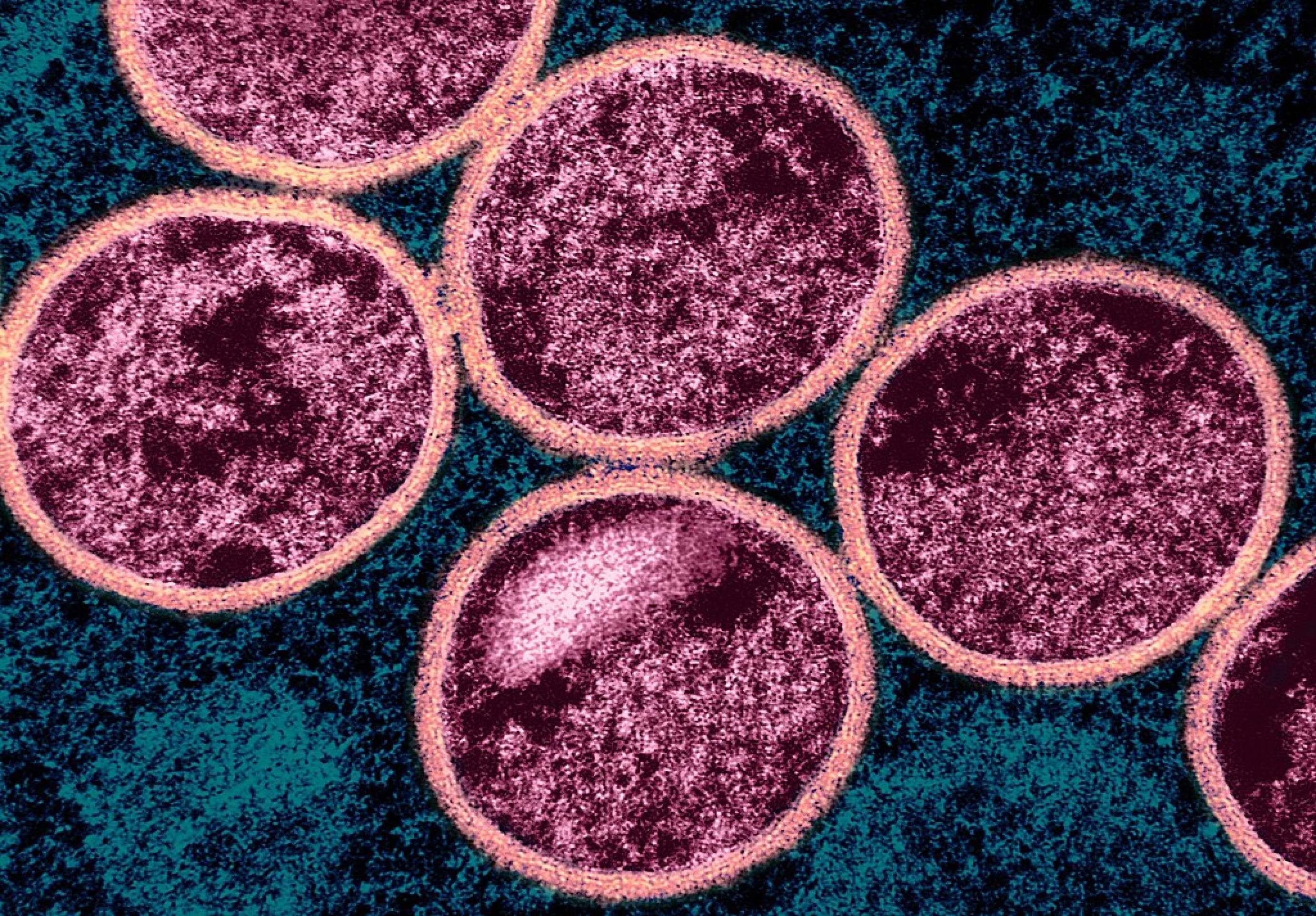 OMS mantém alerta por epidemia de mpox