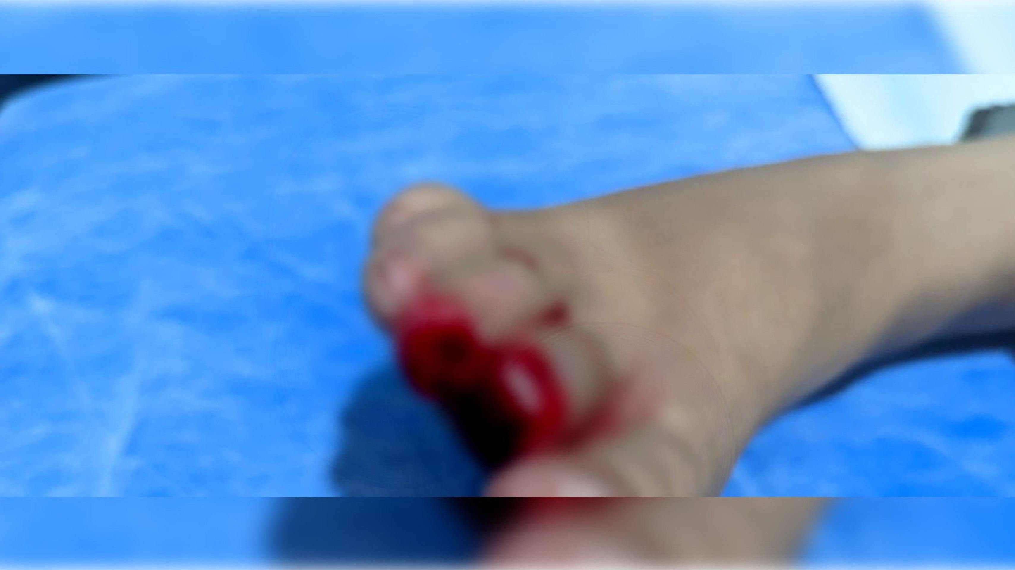 Mãe fala sobre ataque de piranha que arrancou dedos da filha em Caldas Novas Mãe fala sobre ataque de piranha que arrancou dedos da filha em Caldas Novas