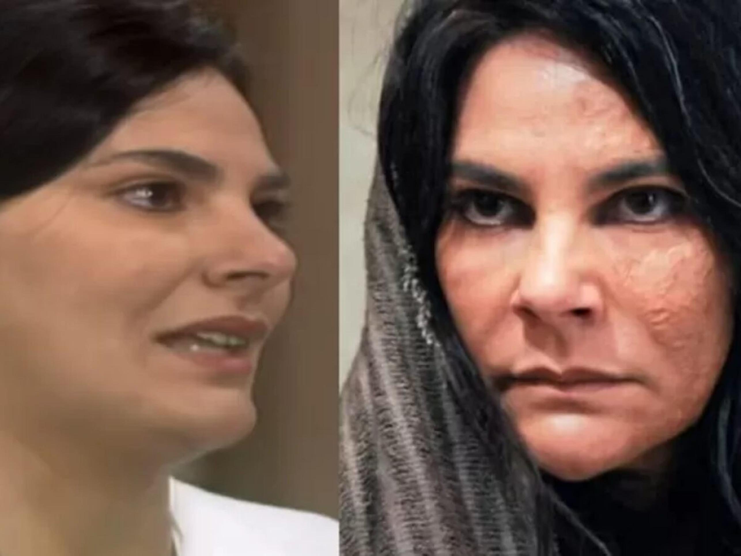 Atriz de ‘A Viagem’ largou TV após sofrer queimaduras em gravação de novela -  (crédito: Observatorio dos Famosos)
