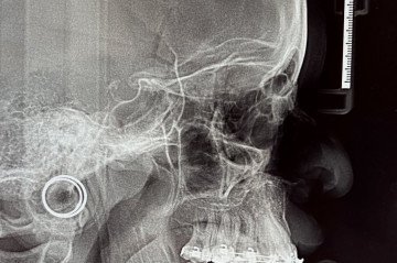 Morada
De Lua Cavalcante. Curadoria: Gisele Lima e Likidah Ferreira. Abertura amanhã, às 17h, na Pilastra Galeria-Escola (QE 40 Rua 09 lote 08, Polo de modas, Guará II). Visitação até 9 de agosto, de quarta a sexta, das 14h às 19h, e sábado, das 10h às 15h. Classificação indicativa livre 
