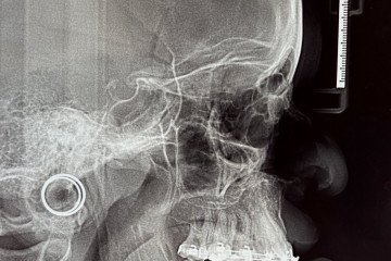 Morada
De Lua Cavalcante. Curadoria: Gisele Lima e Likidah Ferreira. Abertura amanhã, às 17h, na Pilastra Galeria-Escola (QE 40 Rua 09 lote 08, Polo de modas, Guará II). Visitação até 9 de agosto, de quarta a sexta, das 14h às 19h, e sábado, das 10h às 15h. Classificação indicativa livre 
