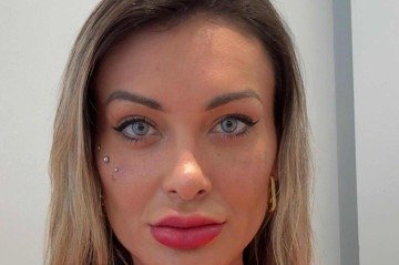 Andressa Urach muda cor dos olhos com cirurgia feita na Europa - (crédito: Portal LeoDias) Andressa Urach muda cor dos olhos com cirurgia feita na Europa - (crédito: Portal LeoDias)