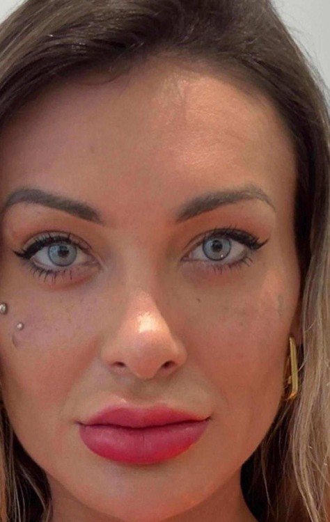 Andressa Urach muda cor dos olhos com cirurgia feita na Europa -  (crédito: Portal LeoDias)