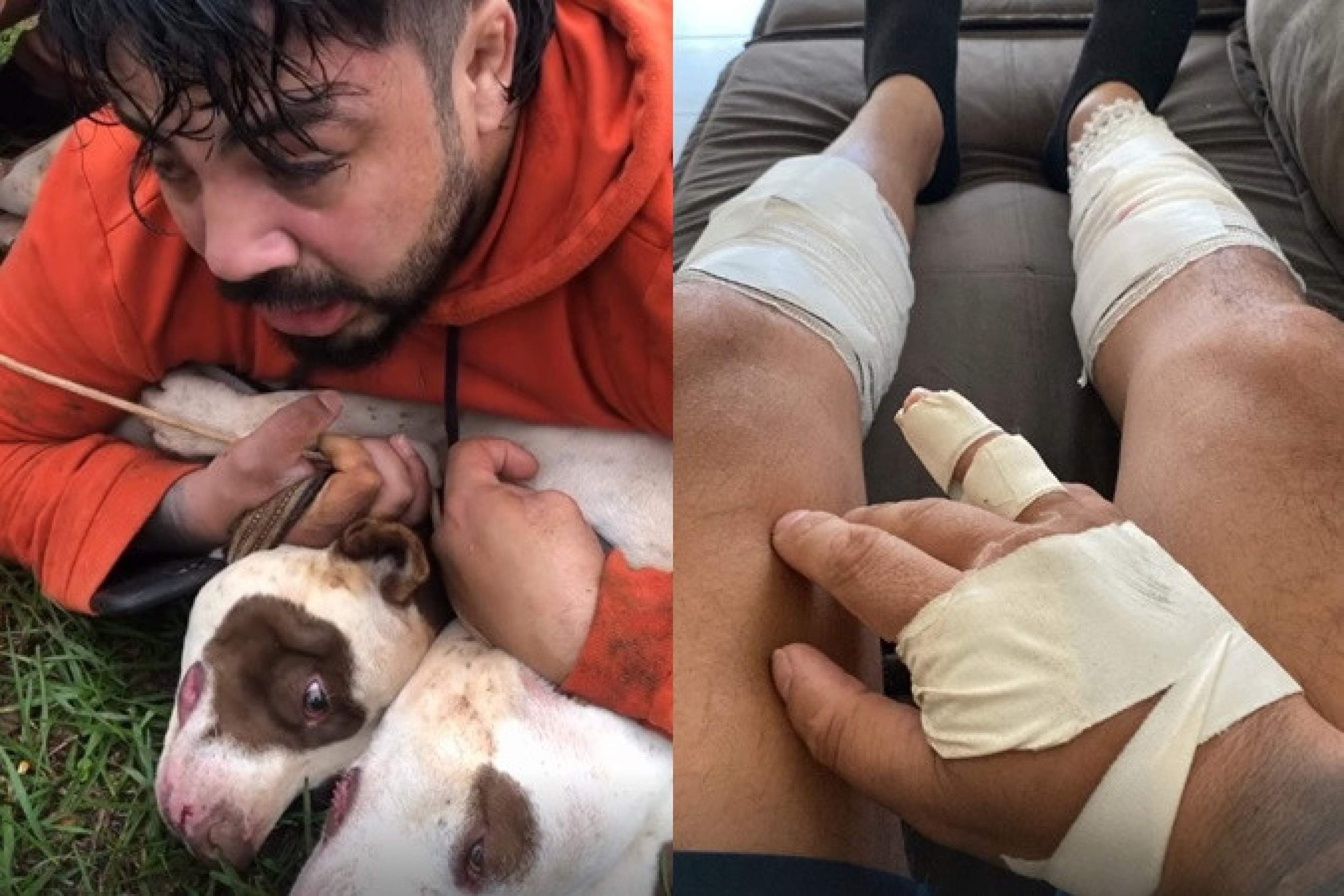 Lutador de muay thai imobiliza dois pitbulls após ataque: 