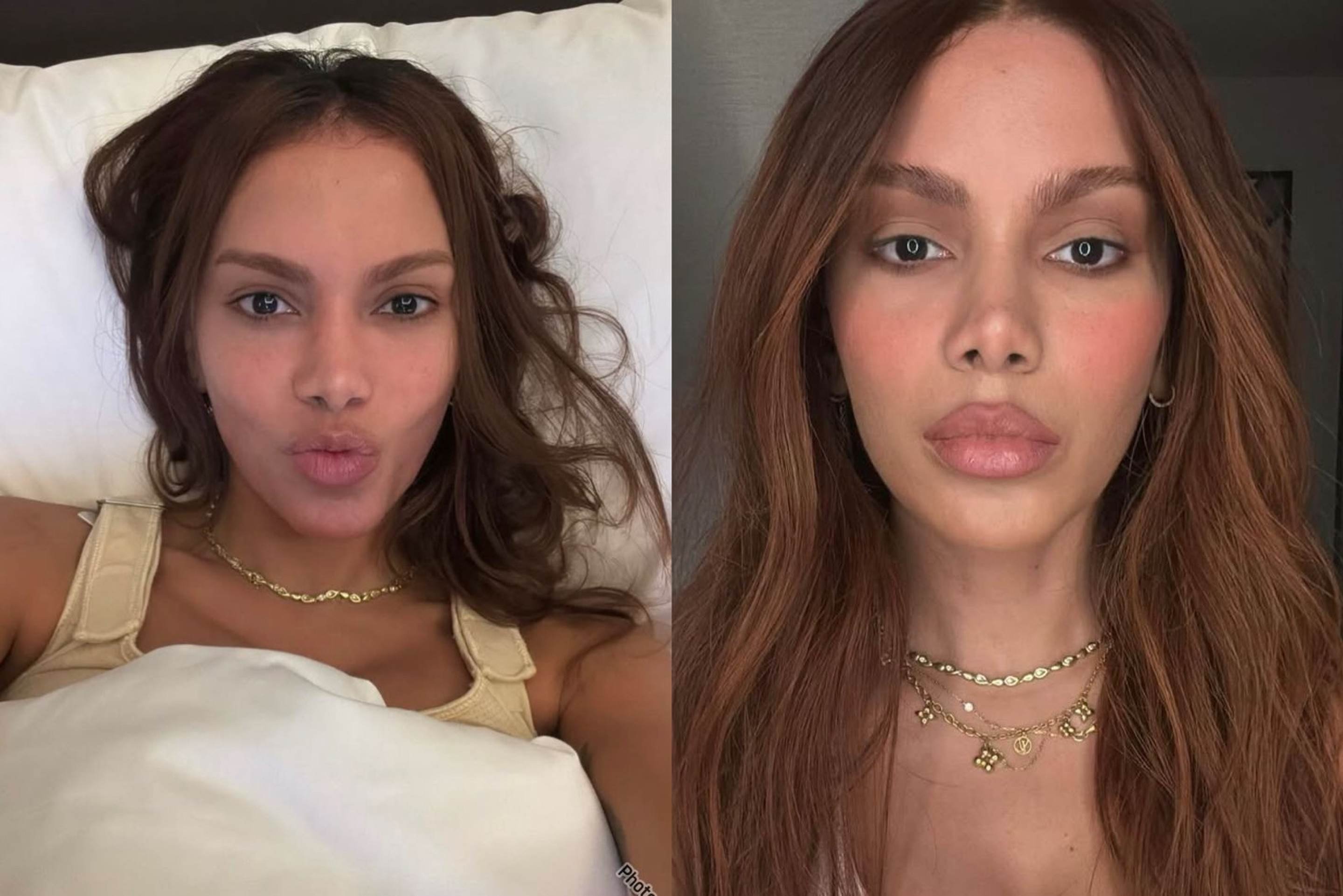Anitta surge em novos registros com rosto irreconhecível e web reage