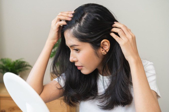 Cuidados simples ajudam a tratar a caspa sem agredir os cabelos (Imagem: Kmpzzz | Shutterstock)  -  (crédito: EdiCase)