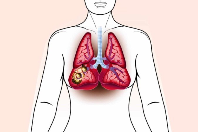 Da boca ao pulmão - (crédito: Editoria de Arte) Da boca ao pulmão - (crédito: Editoria de Arte)