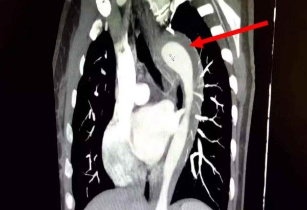 Reprodução/American Journal of Case Reports