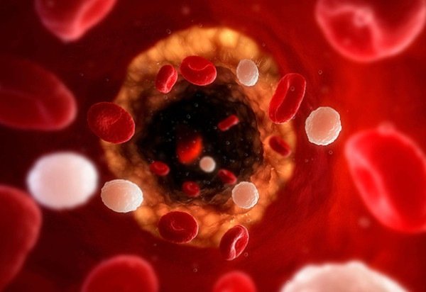 CreativeCommons/Divulgação