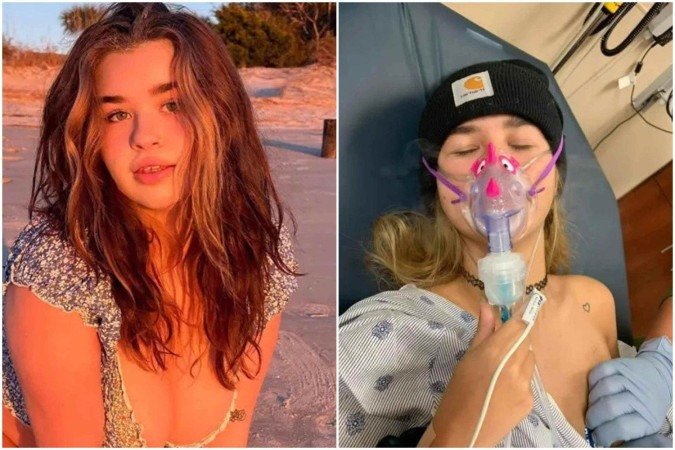 Ela foi levada ao hospital e os médicos detectaram um quadro de infecção fúngica agressiva - (crédito: Reprodução/Redes sociais) Ela foi levada ao hospital e os médicos detectaram um quadro de infecção fúngica agressiva - (crédito: Reprodução/Redes sociais)