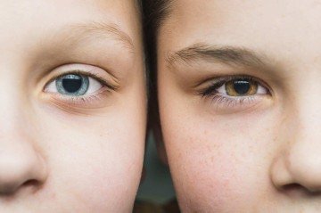 Heretocromia olhos - (crédito: Freepik) Heretocromia olhos - (crédito: Freepik)
