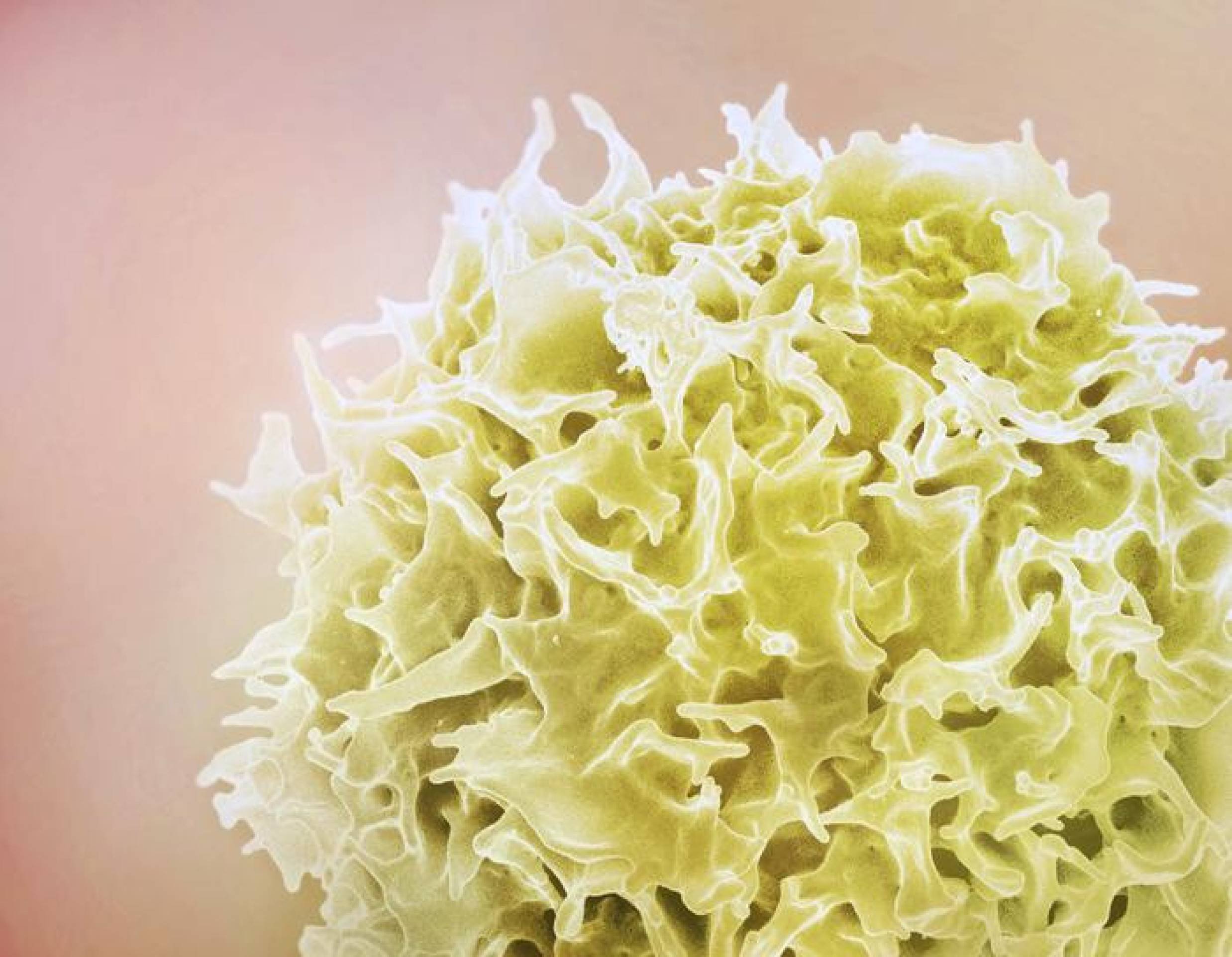 Remédios para HIV são a chave para curar o vírus HTLV-1