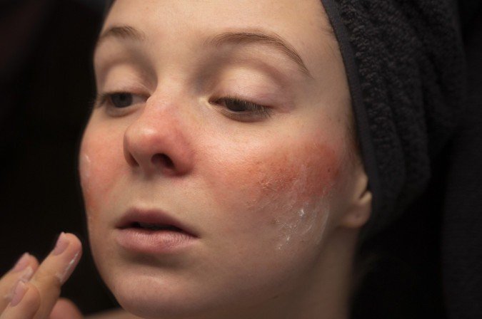 O ar frio e seco e a baixa umidade do ar são desafios mesmo para quem capricha na hidratação -  (crédito: Reprodução: eugene barmin/Freepik)